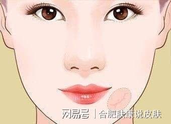 从颜色看“疤痕增生”严重程度，你的疤痕到哪个阶段了 ？