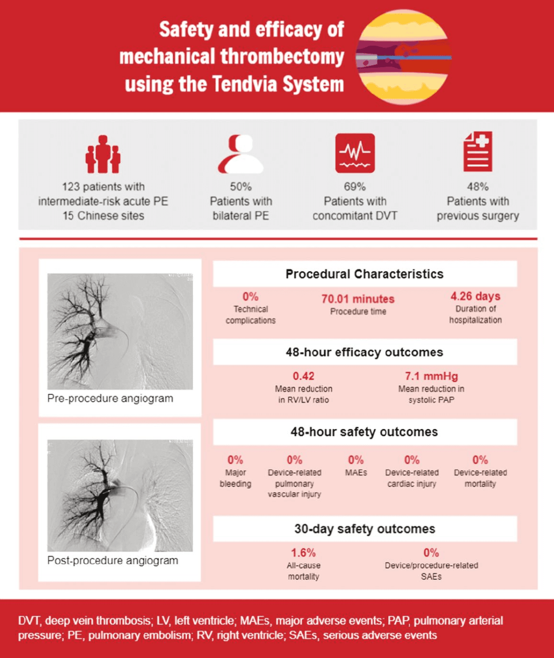 腾复医疗Tendvia®机械取栓系统治疗急性肺栓塞的CLEAR研究重磅发表