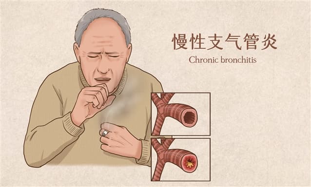 守护慢支老人的温暖防线