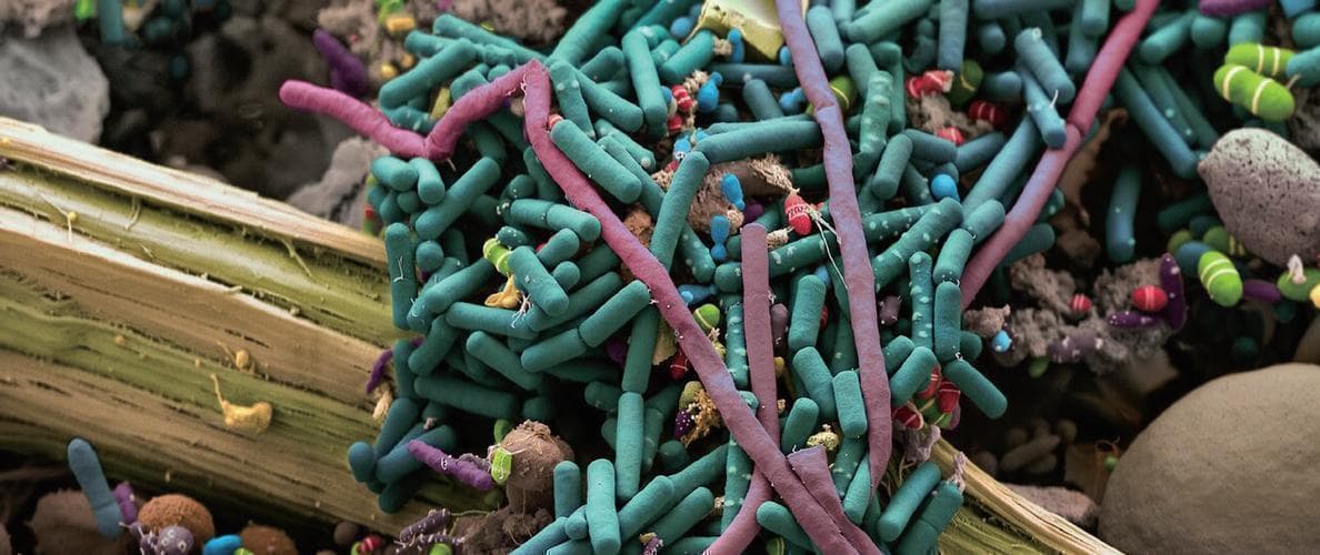 微生物、情绪和心理健康之间的联系