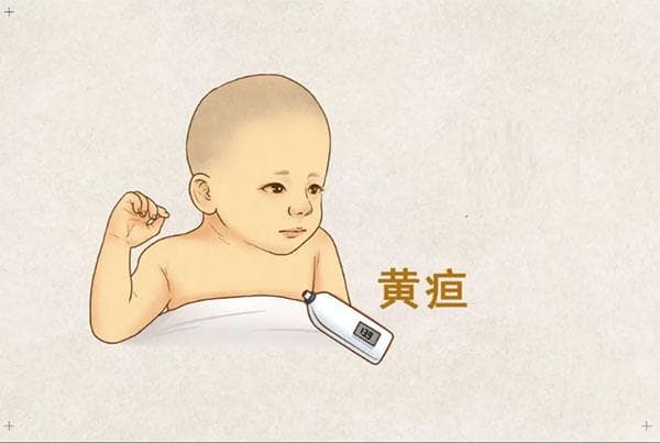 燕医科普｜新生儿黄疸知多少？守护婴儿健康从了解开始