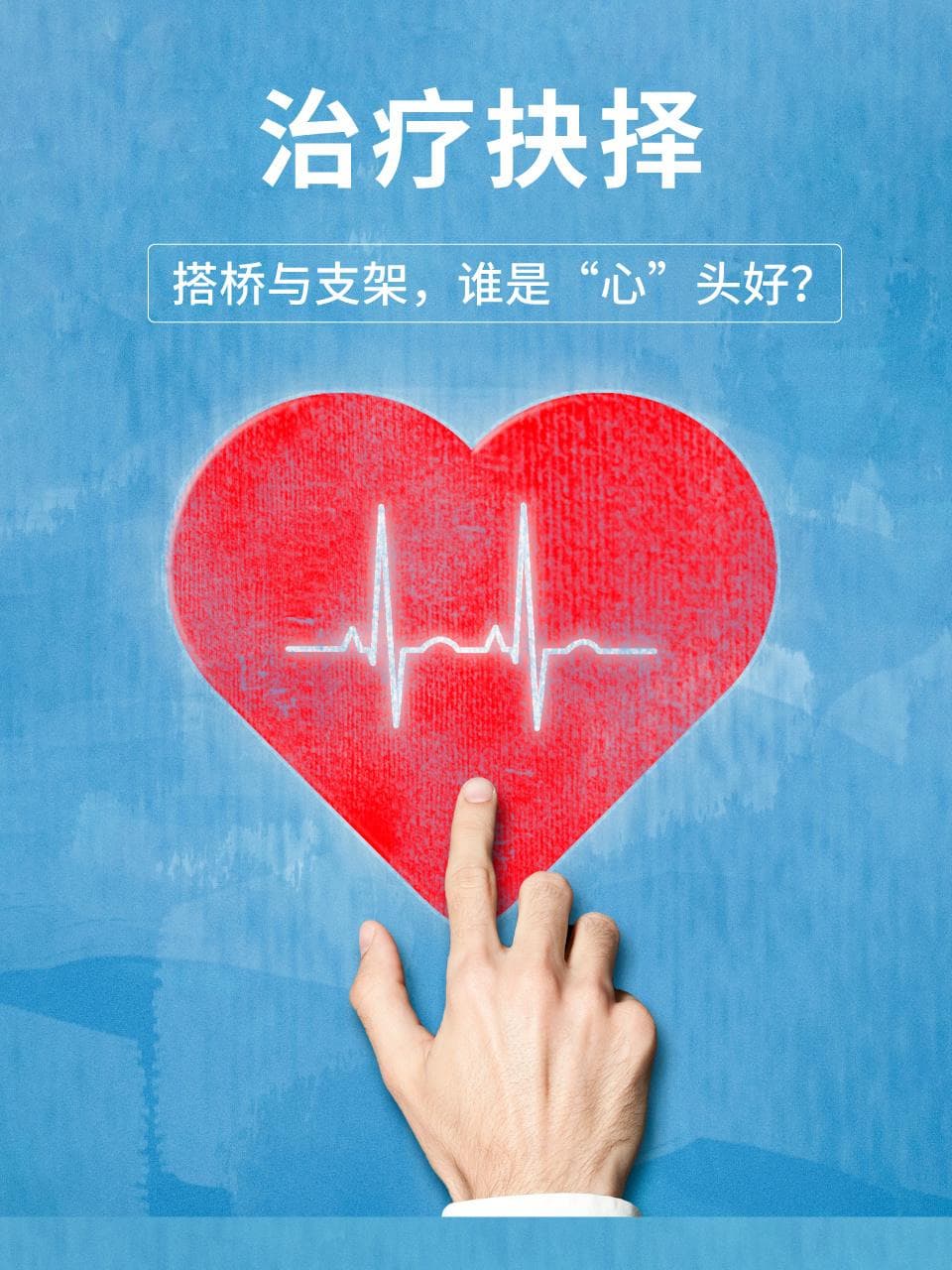 治疗抉择：搭桥与支架，谁是“心”头好？