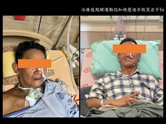 安南医院脑神经团队成功救治昏迷患者 TMS经颅磁刺激助力恢复意识