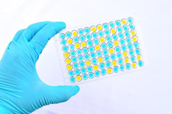 醛固酮检测用什么方法