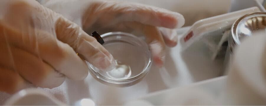 果酸换肤：原理、功效与使用指南