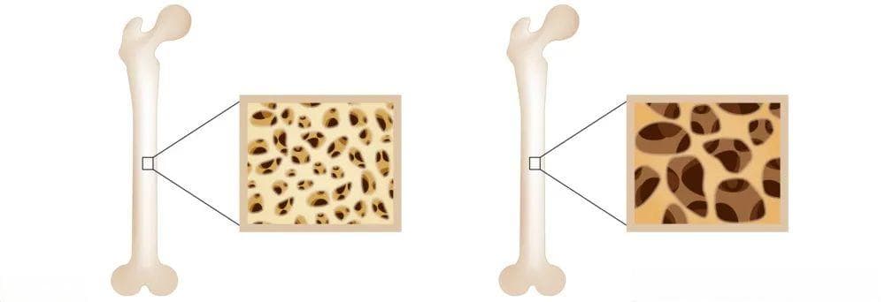 如何把钙补到位？药师教你科学使用钙补充剂