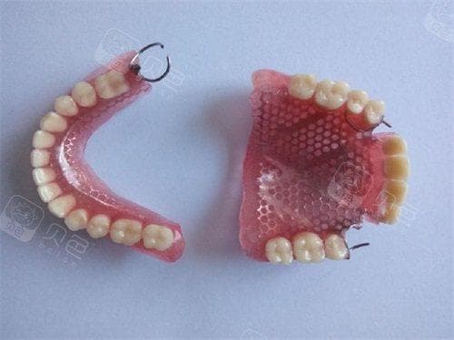 单颗牙缺失修复指南：活动义齿、固定义齿与种植义齿的优劣分析