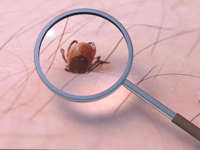 过去几乎人人身上都有虱子，为啥现在几乎见不到了？虱子是什么？