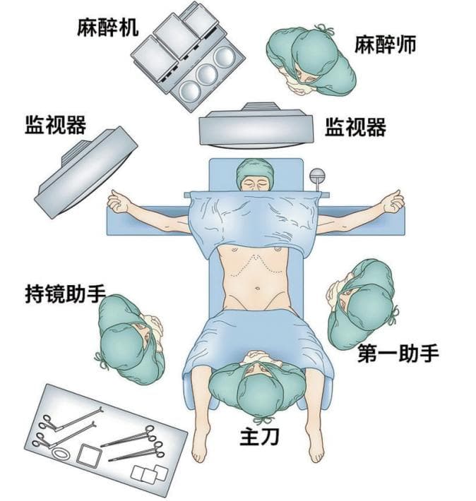 化繁为简 | 食管裂孔疝及胃食管反流腹腔镜下手术「七步法」