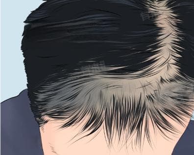 吃什么能生发？从营养到护理的全面指南