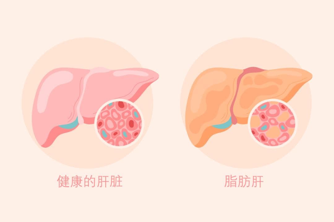 @中老年人群：科学减重这样做→