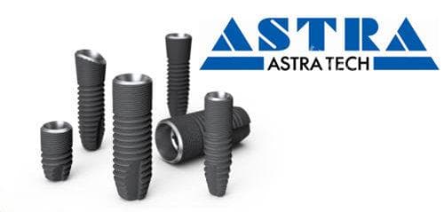 Astra种植体和ITI种植体哪个好？从技术、价格到患者反馈的全面对比
