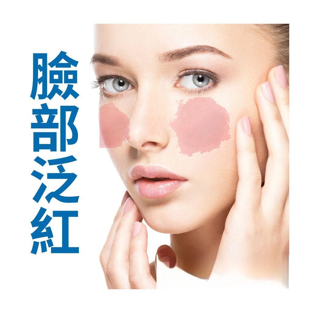 脸部泛红原因有哪些？该怎么做？医师教你判断脸颊泛红是过敏还是玫瑰斑