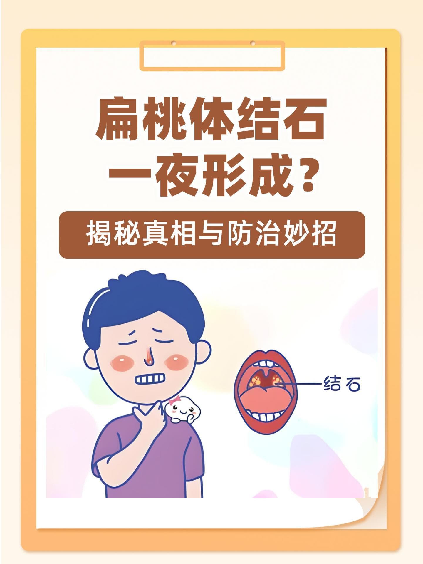 扁桃体结石非一日之寒，正确刷牙可预防