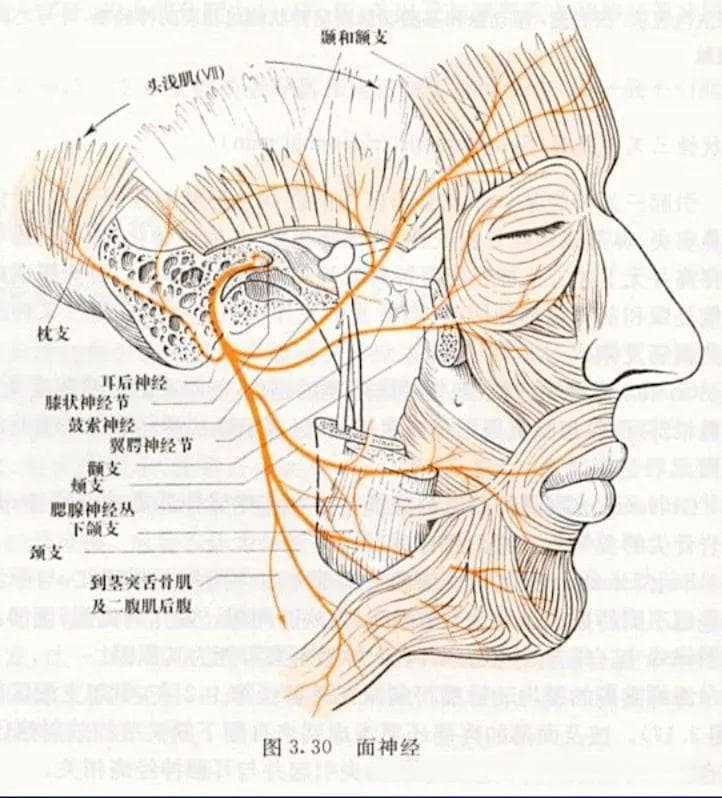 从Bell面瘫到Ramsay Hunt综合征（RHS）