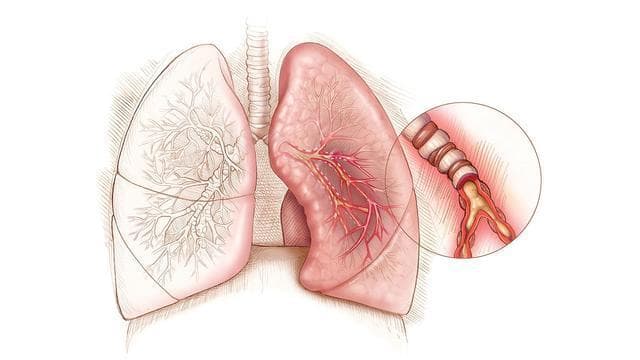 研究证实：贝伐珠单抗联合复方万年青胶囊可增强肺癌治疗效果