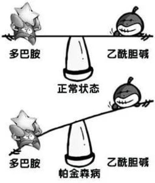 帕金森病=老年痴呆吗？