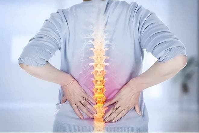 腰间盘突出的成因、症状与预防：一份全面的健康指南