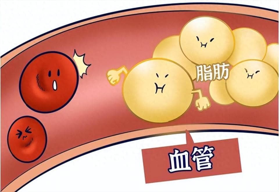 降脂必读：这些食物和习惯要当心