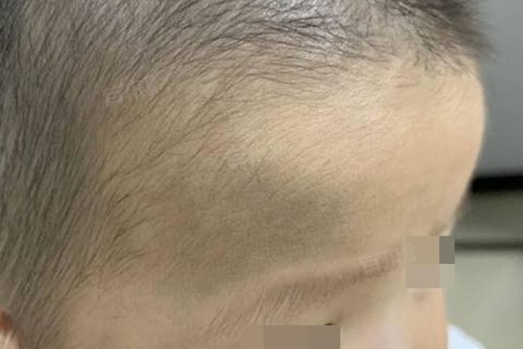 印堂发黑是什么征兆