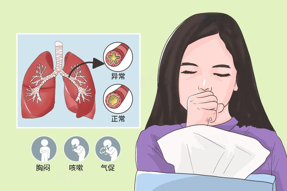 儿童慢性支气管炎的成因与治疗