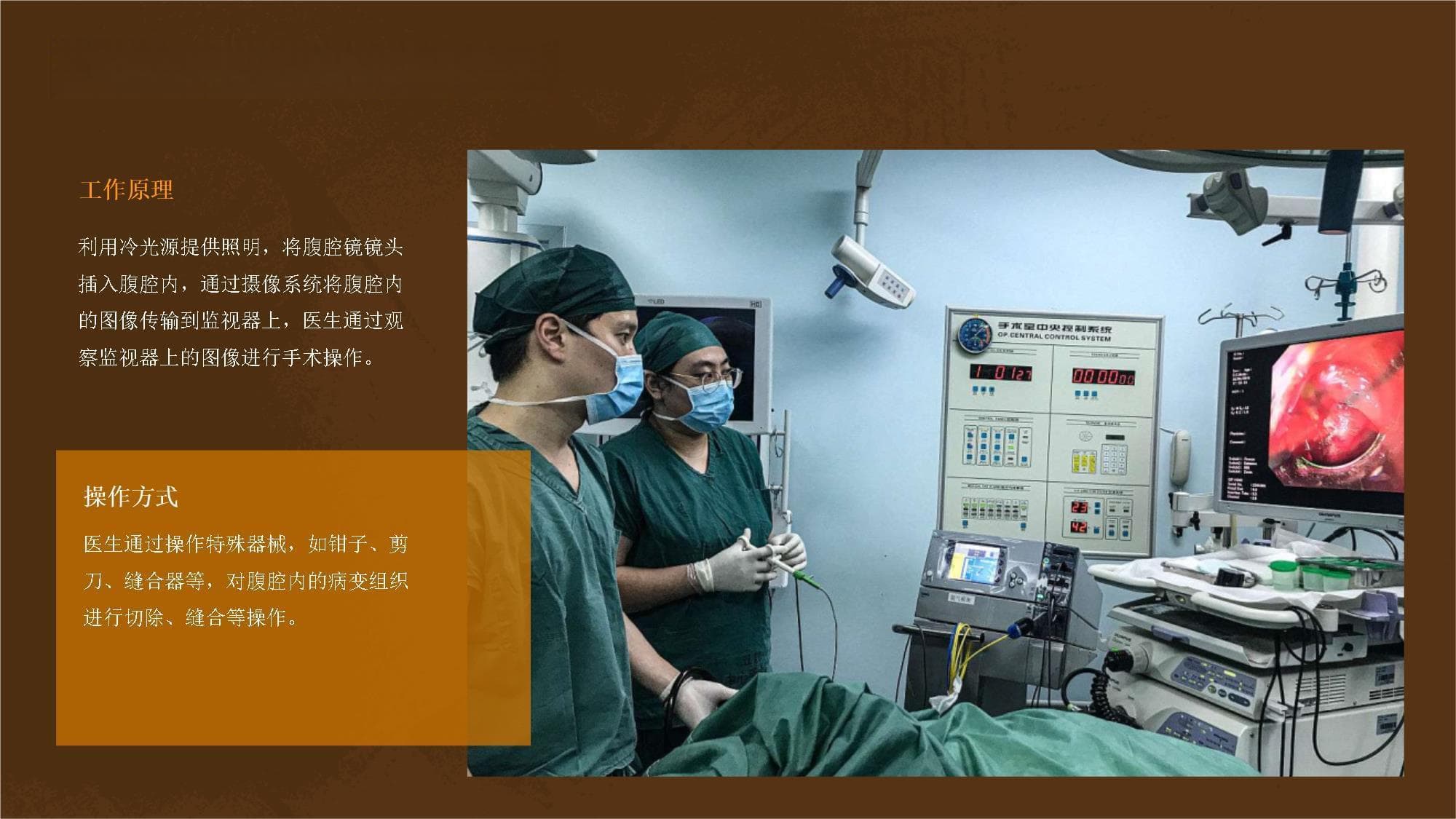 腹腔镜手术的介绍与应用