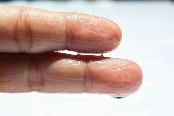 手经常泡水要怎么保护？这份护理指南助你远离手部问题！