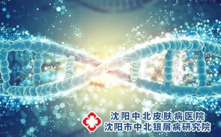 银屑病的诱发因素都有哪些？