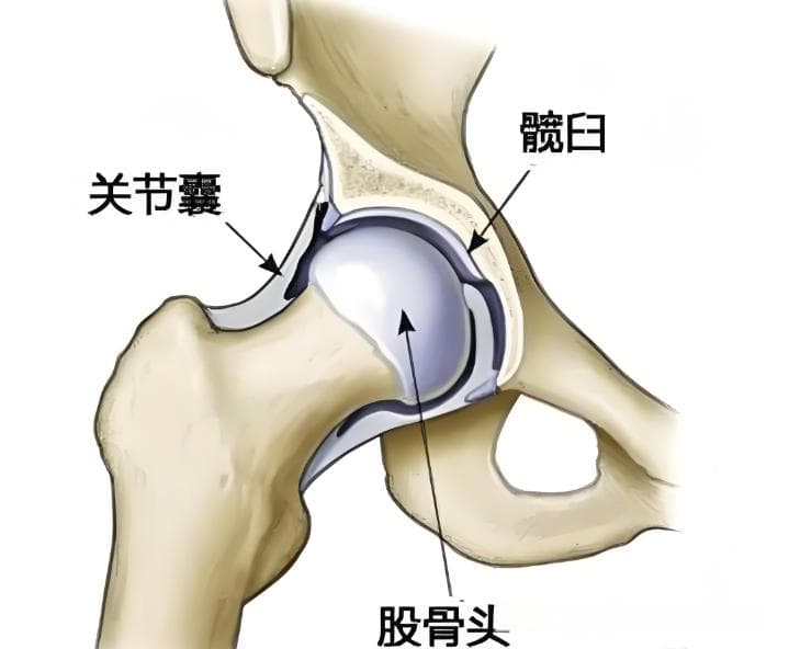 稳定髋关节，“干掉”弹响髋