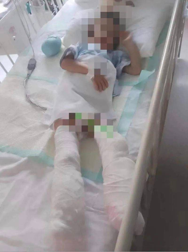 虐待5岁儿子致截肢的女子，判了！父亲发声