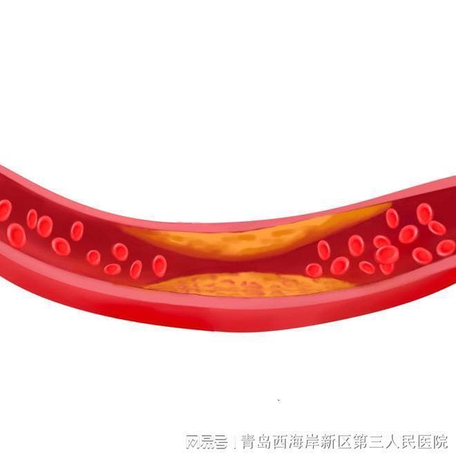 【医疗科普】认识人体血脂的组成及其作用