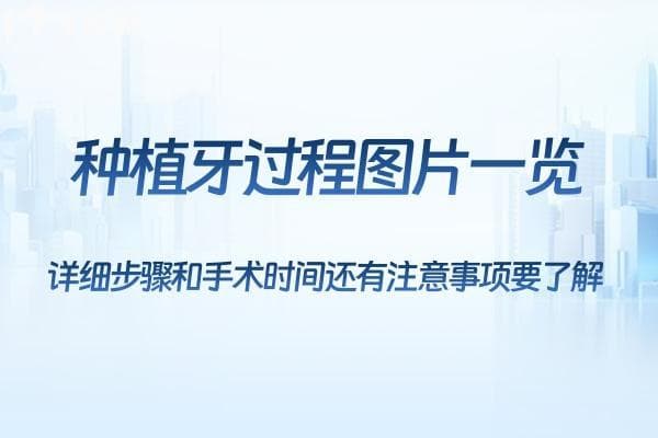 种植牙过程详解：从术前评估到最终修复，你需要了解的全部步骤和注意事项