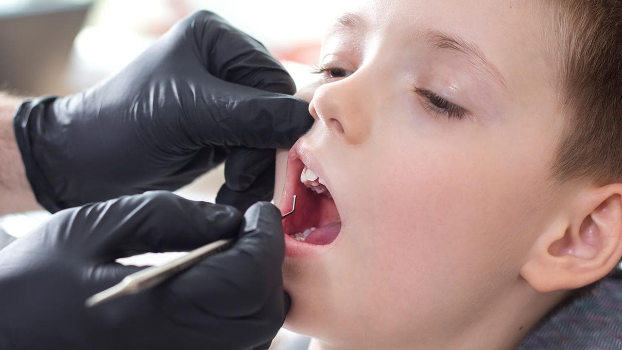 吃什么对牙齿健康有益？10大食物保护牙齿不蛀牙