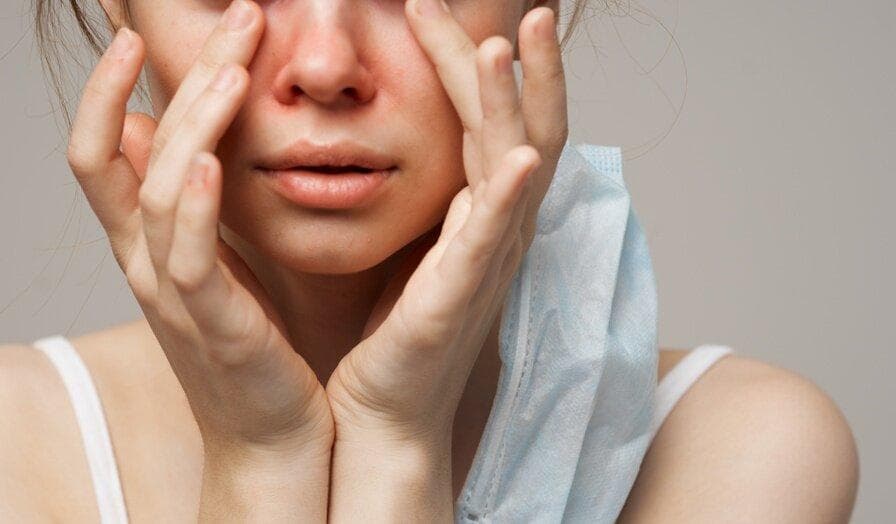 酒糟鼻的成因、症状及治疗方法全解析