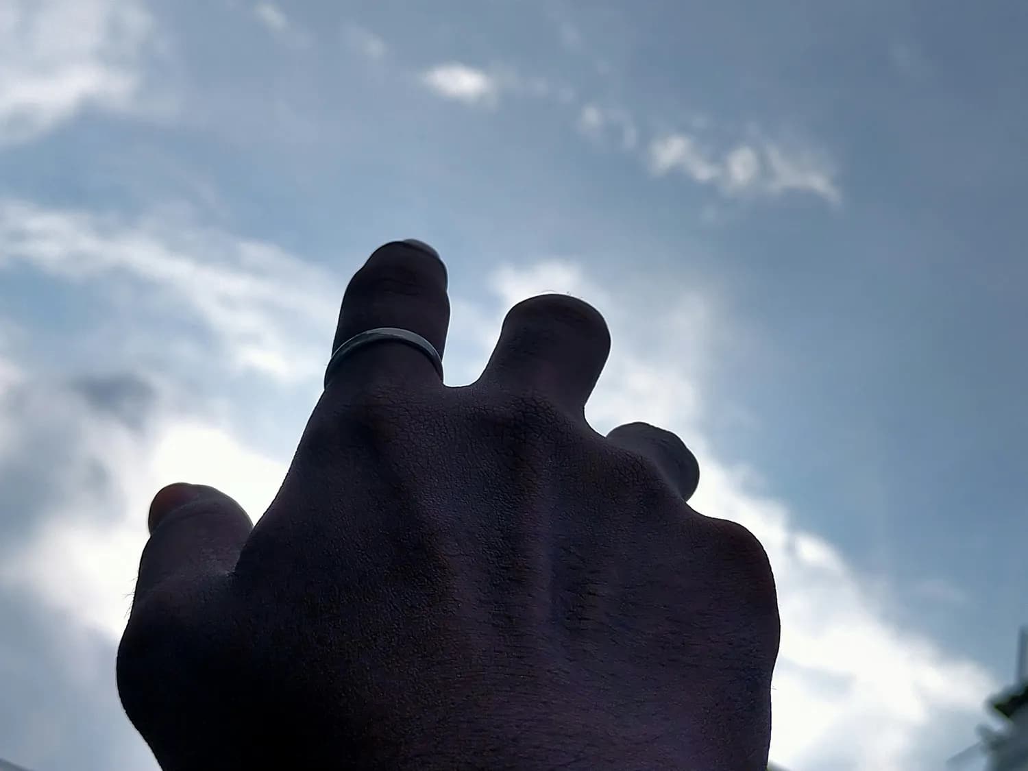 手机使用不当致手指长包，专家：还可能引发颈椎病等