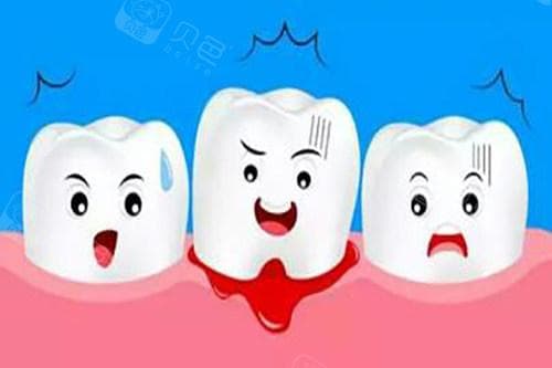 牙龈长了个凸起的肉疙瘩不疼不痒：可能疾病及应对方法！