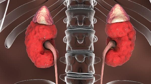 肾上腺健康检查全解析：五种常用检测方法详解