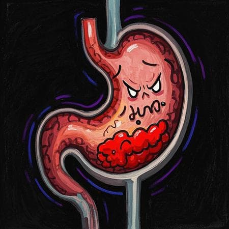 胃癌远离四步走，健康生活不用愁
