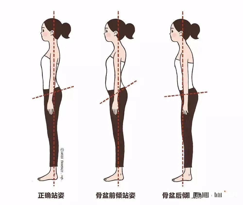 髋关节疼痛：坐骨股骨撞击综合征