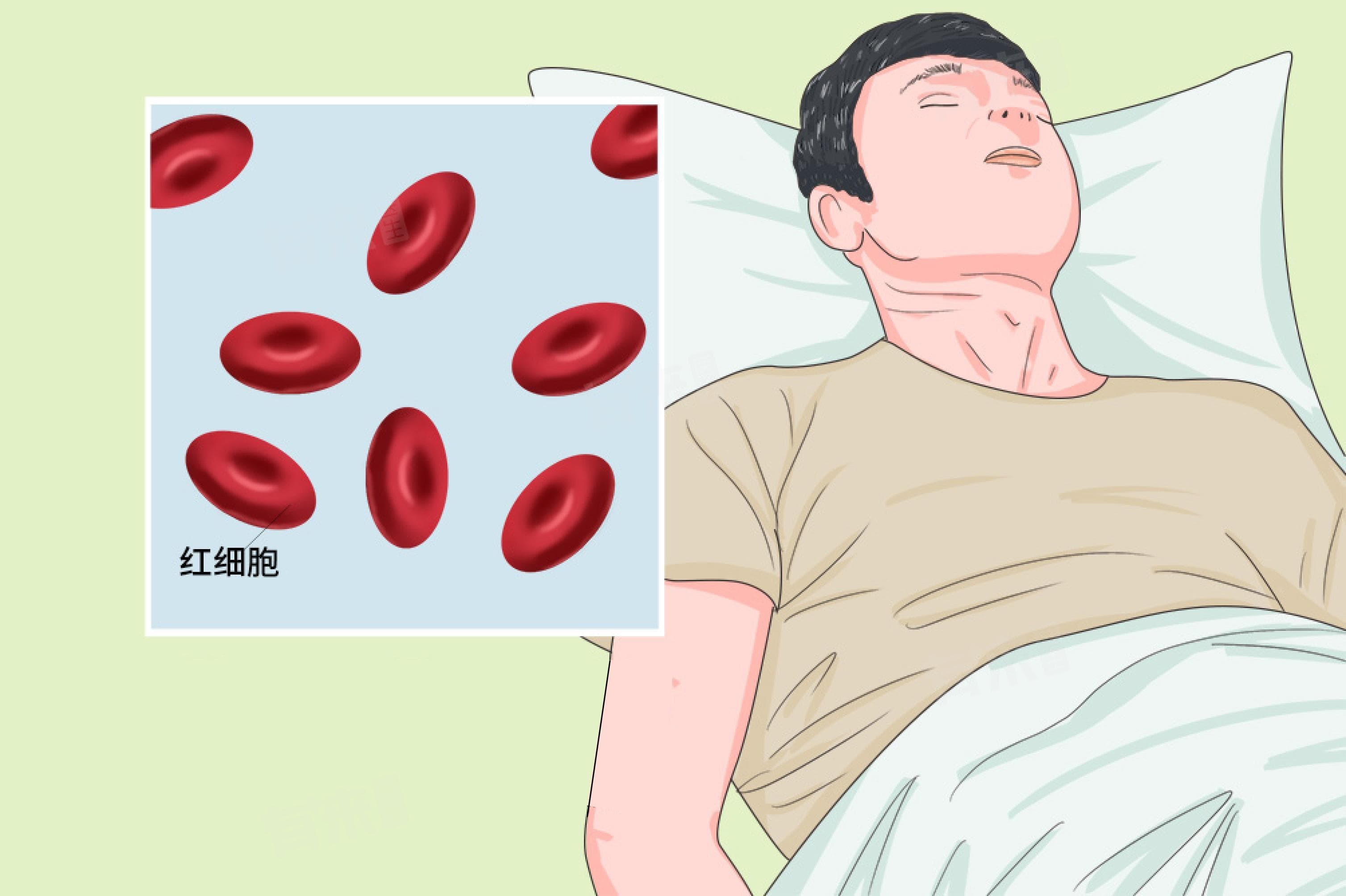 红细胞压积偏低多少才是严重