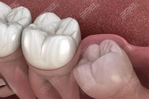 拔牙多少钱一颗2025价格表：儿童拔牙/成人烂牙/智齿价格提前看