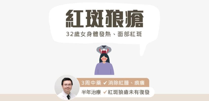 系统性红斑狼疮：中西医结合治疗案例