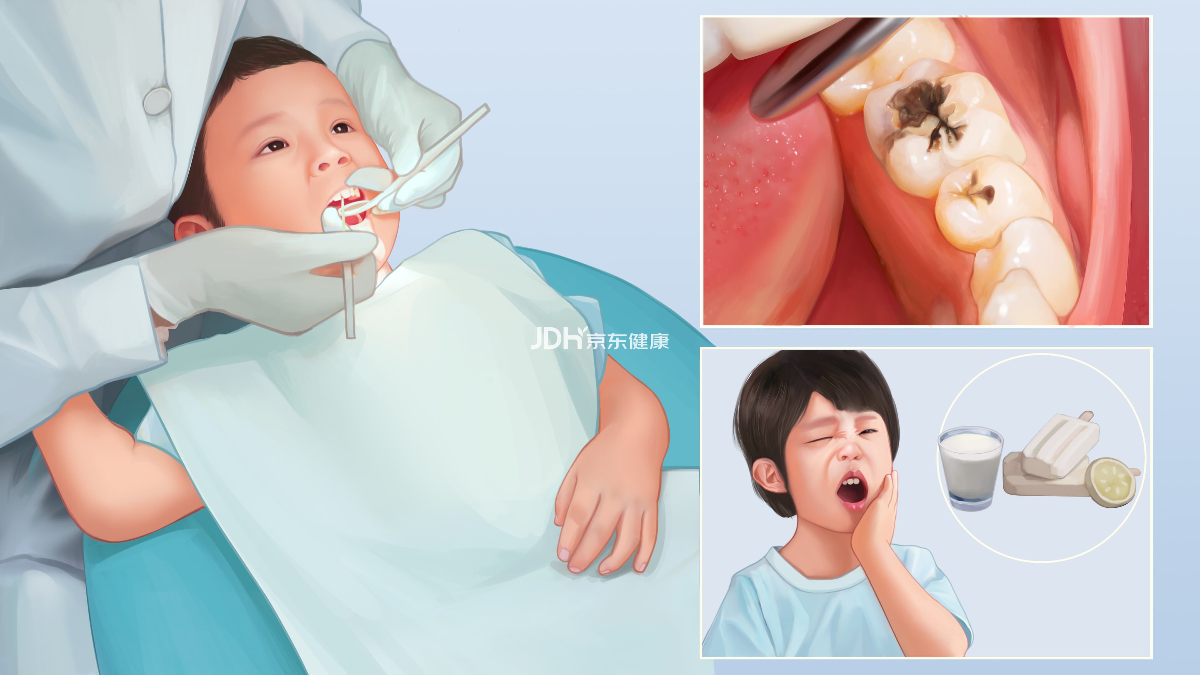 龋齿：病因、症状与治疗全解析