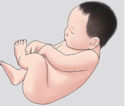 新生儿体重标准及护理指南