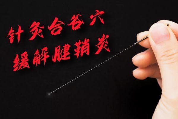 腱鞘炎的针灸治疗