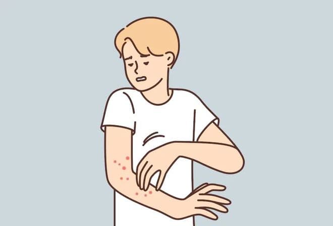 尿毒症皮肤瘙痒：肾友的「痒」苦，如何终结？