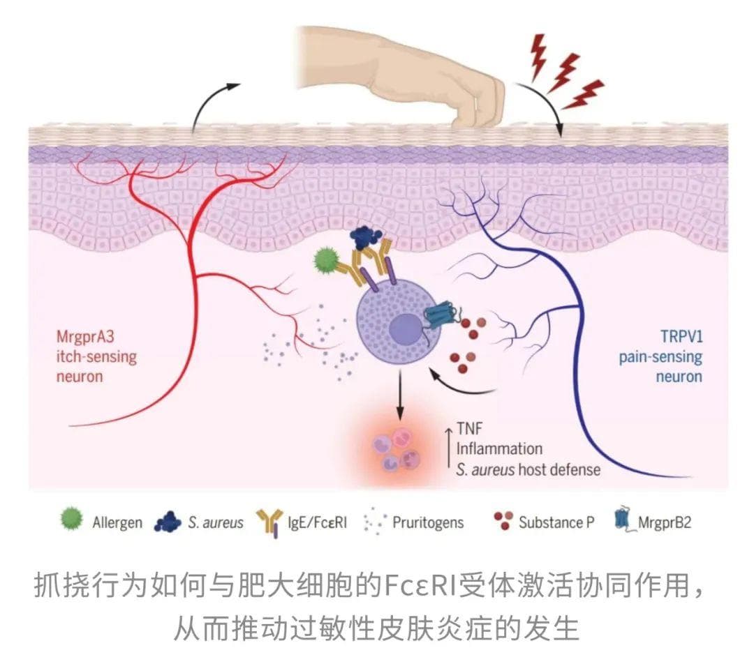 Science最新研究：挠痒痒加剧皮肤炎症，却能抵抗细菌感染