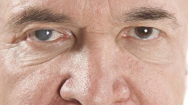 飞蚊症：成因、特点及管理方法全解析