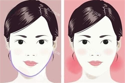 怎么判断是正畸还是正颌？解析其定义与原理，并分享以下五种判断依据给大家