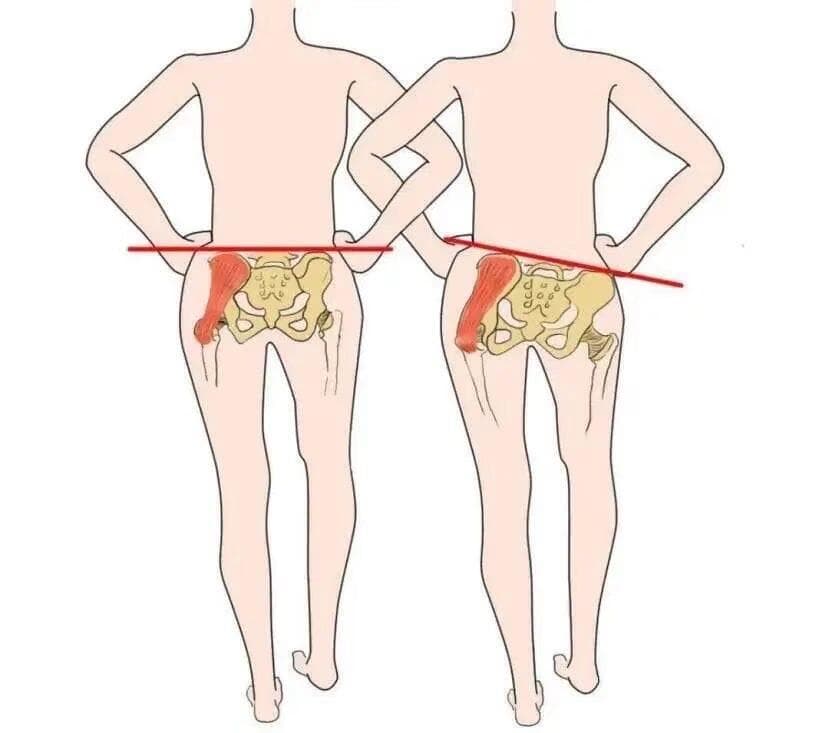 臀部发力走路真的能瘦腿吗？正确姿势详解
